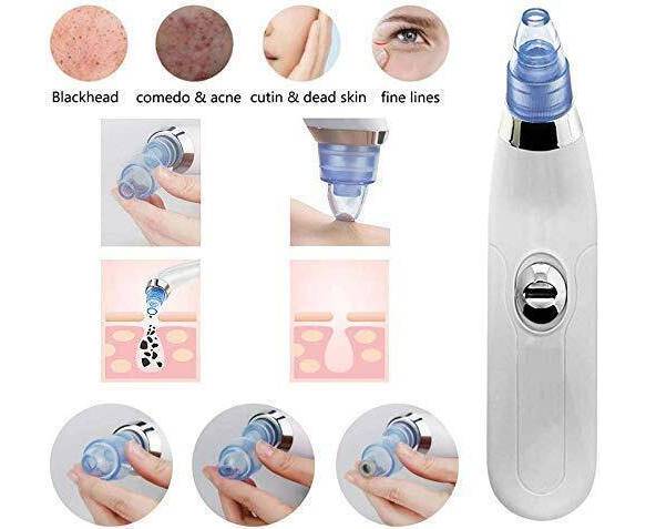 Blackhead Suction Remover & Pore Vacuum